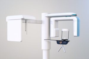 cone beam digital dental xray machine